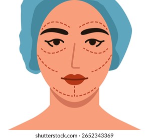 Rosto de menina bonita com linhas de incisão com marcador. Face feminina com linhas de incisão com marcador. Ilustração plana de cirurgia plástica