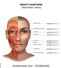 Beauty aesthetic injections treatment areas. Muscles structure of the female face and neck, each muscle with name on it.