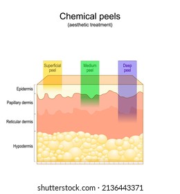 Beauty aesthetic treatment. Chemical peels. Deep, medium, Superficial peel. Cross section of layers of human skin. Vector illustration