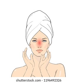 Beauty care illustration. Skin problems solution. Skin layer of woman which appear redness on facial from sunburn. Illustration about danger of Ultraviolet radiation. Vector Spa girl