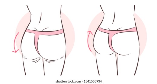 beauty cartoon woman with butt implant before and after