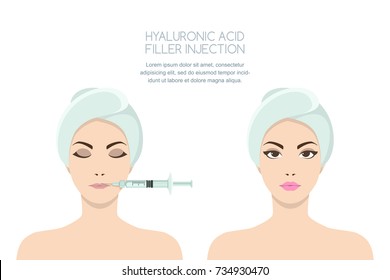 Beauty, cosmetology, anti-aging concept. Before and after vector illustration of beautiful woman having hyaluronic acid filler lips injection. Female rejuvenating injection against the wrinkles.