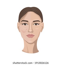 Beauty and freshness of woman face vector illustration. Girl with skin spots, pimples and wrinkles