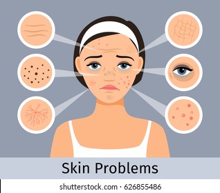 Beauty and freshness of the woman face vector illustration. Girl with skin spots, pimples and wrinkles