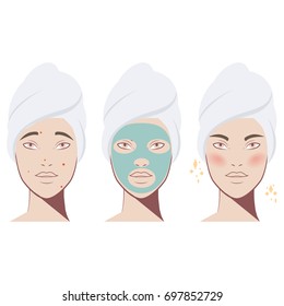 Beauty girl. Acne treatment before after, facial cleansing foam, cartoon illustration. Face mask