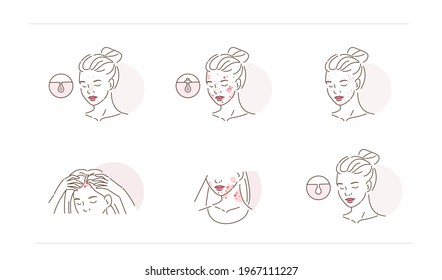 Beauty Girl Have Acne on her Face, Neck and Hair Skin. Blackheads, Whiteheads, Post Acne and other Acne Skin Problems. Flat Line Cartoon Illustration. Flat Line Vector  Illustration and Icons set.