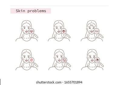 Beauty Girl Have Skin Problems. Acne, Wrinkles, Pigmentation, Dry Skin and Dark Spots.  Different Skin Conditions and Diseases. Flat Line Cartoon Vector Illustration.