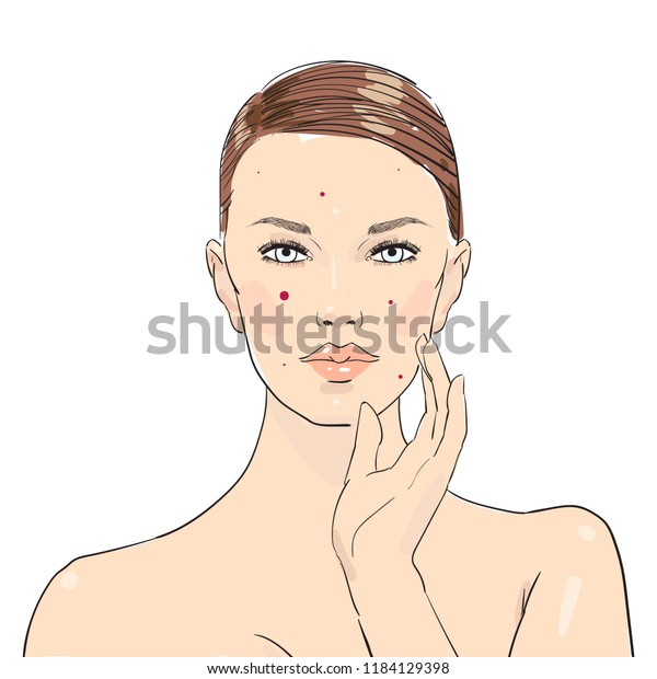 Beauty Girl Rash On Face Illustration Stock Vector Royalty Free