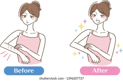 Beauty Hair Removal Arms Women Illustrations
