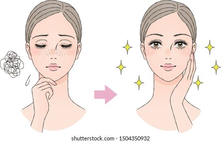 Beauty Image To Treat Freckles. Vector