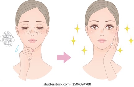 Beauty image to treat freckles. Vector