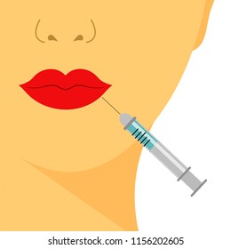 Beauty plastic. Lip augmentation. Hyaluronic Acid injections. Salon procedure. Vector Illustration.
