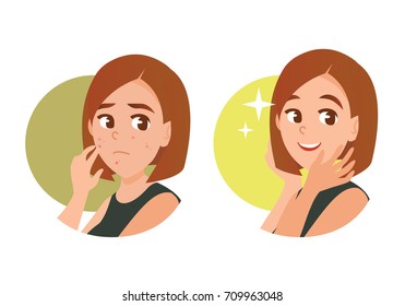 Beauty woman with acne problem before and after