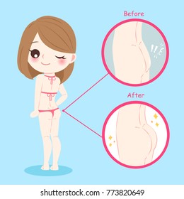 beauty woman with butt implant before and after