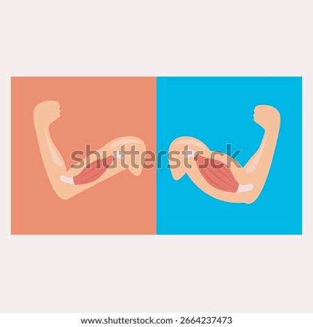Becker muscular dystrophy vector: strong vs weak muscle hands, showing muscle loss, symptoms, and related neuromuscular diseases. arm icon