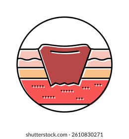 bedsore pressure ulcers disease color icon vector. bedsore pressure ulcers disease sign. isolated symbol illustration