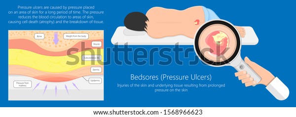 Bedsores (pressure ulcers) injuries\
skin underlying tissue from lying down or sitting prolonged period\
time with paralysis patient and immobility\
adults