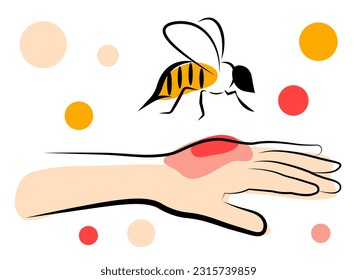 The bee bit the man's hand. Vector illustration in doodle style