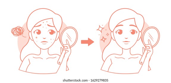 Before and after acne. Acne icons. Cute cartoon illustration with a girl with acne.