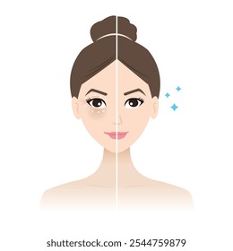 Before and after apply eye cream treatment vector illustration on white background. The cute woman apply eye cream to treat under eye bags, reduce dark circles, puffiness, dryness, crow feet lines.