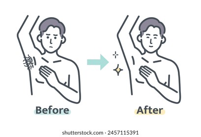 Before and after armpit hair removal