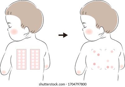 Patch Test Back Imagenes Fotos De Stock Y Vectores Shutterstock