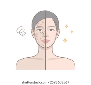 Before and after of cute woman character with skin trouble as pimple, blackhead, whitehead, zit, blemish, acne, freckle, papule and woman with clear and clean skin.  Portrait of cosmetic female model.