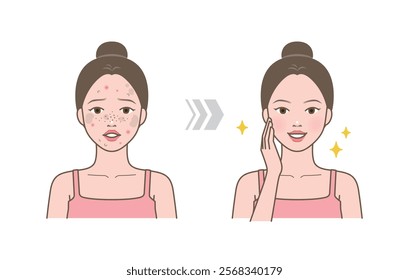 Before and after of cute woman with skin trouble as pimple, blackhead, whitehead, zit, blemish, acne, freckle, papule and woman with clear and clean skin