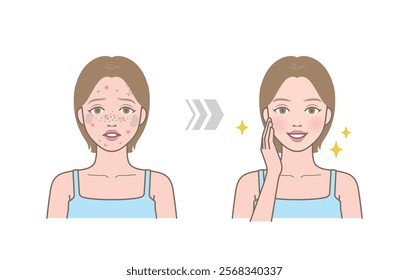 Before and after of cute woman with skin trouble as pimple, blackhead, whitehead, zit, blemish, acne, freckle, papule and woman with clear and clean skin