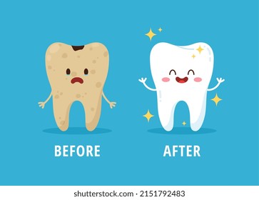 Before and after dental cleaning or whitening and treatment, flat vector illustration on blue background. Cute teeth characters. Yellow tooth with caries and shiny healthy tooth.