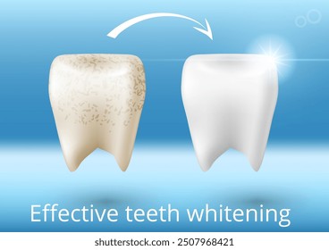 Before And After Effective Teeth Whitening 3D Poster. EPS10 Vector