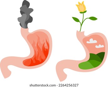 Before and after heartburn treatment. Fire with smoke as acid indigestion and green field as healthy condition, stomach illustrations on white background. Gastroesophageal reflux disease
