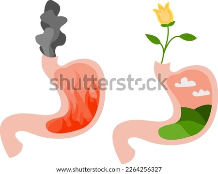 Before and after heartburn treatment. Fire with smoke as acid indigestion and green field as healthy condition, stomach illustrations on white background. Gastroesophageal reflux disease