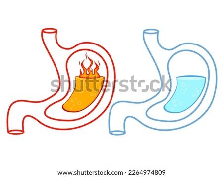 Before and after heartburn treatment. Lava as acid indigestion and water as healthy condition, stomach illustrations on white background. Gastroesophageal reflux disease