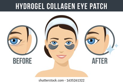 Before and after hydrogel eye patches. Cosmetic collagen eye patches. Black eye patches for beauty and skin care. Vector