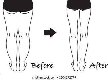 Before after illustration of a diet
(Leg getting thin) the back
Monochrome line drawing