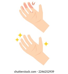 Vorher und Nachher-Illustrationsmaterial für Fingeratopie