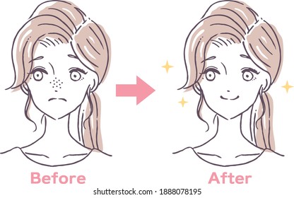 Before and after illustration material of a woman suffering from pore clogging