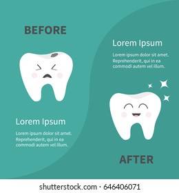 Before after Infographic Healthy smiling tooth icon. Sining star. Crying bad ill teeth with caries. Template with text. Cute character. Oral dental hygiene. Baby background. Flat design. Vector