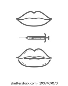 Antes y después de las inyecciones de relleno de labios. Plástico de belleza. Hermosos iconos de línea de labios perfectos. La boca hembra vectora. Aumentación de los labios de cavidad. Procedimiento de salón.