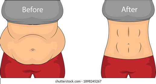 Before and after losing weight. Fat and slender woman in underwear on white background. Weight loss concept. Before and after diet concept. Fat belly and flat belly vector illustration.