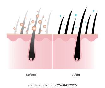 Before and after the mechanism of gray hair coverage shampoo with scalp layer vector illustration isolated on white background. Coloring shampoo, Herbal color serum, hair care concept illustration.