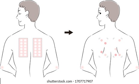 Before And After Men For Patch Test