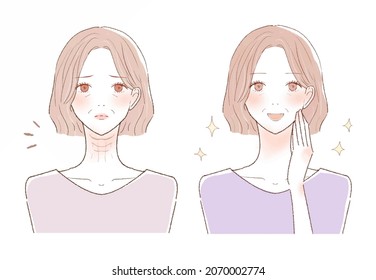 Before and after of a middle-aged woman suffering from wrinkles in the neck. On white background.