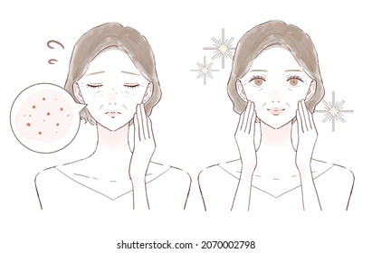 Before and after of middle-aged women suffering from sebum pores. On white background.