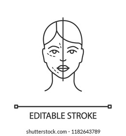 Before and after neurotoxin injection linear icon. Cosmetic procedure. Thin line illustration. Facial rejuvenation. Aesthetic medicine. Contour symbol. Vector isolated outline drawing. Editable stroke