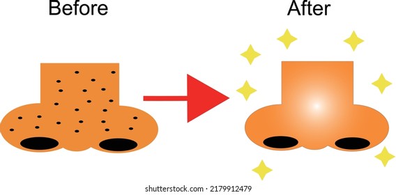 Before and after nose skin care
