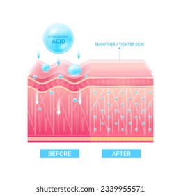 Before and after process of getting skin younger with help of moisturizer collagen. Hyaluronic acid serum drop blue absorbed into the skin cell. Solution for cosmetic advertising. 3D Vector EPS10.