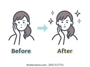 Before and after removing facial blemishes
