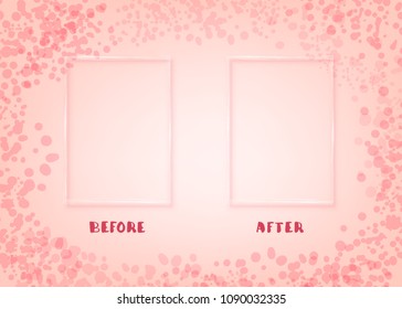 Before After Frame 图片、库存照片和矢量图 Shutterstock